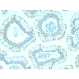 Immunohistochemistry - Anti-SMAD4 Antibody [SMAD4/2440] - BSA and Azide free (A252451) - Antibodies.com