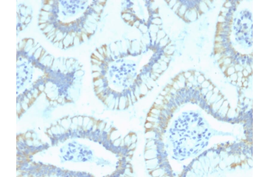 Immunohistochemistry - Anti-SMAD4 Antibody [SPM448] - BSA and Azide free (A252451) - Antibodies.com