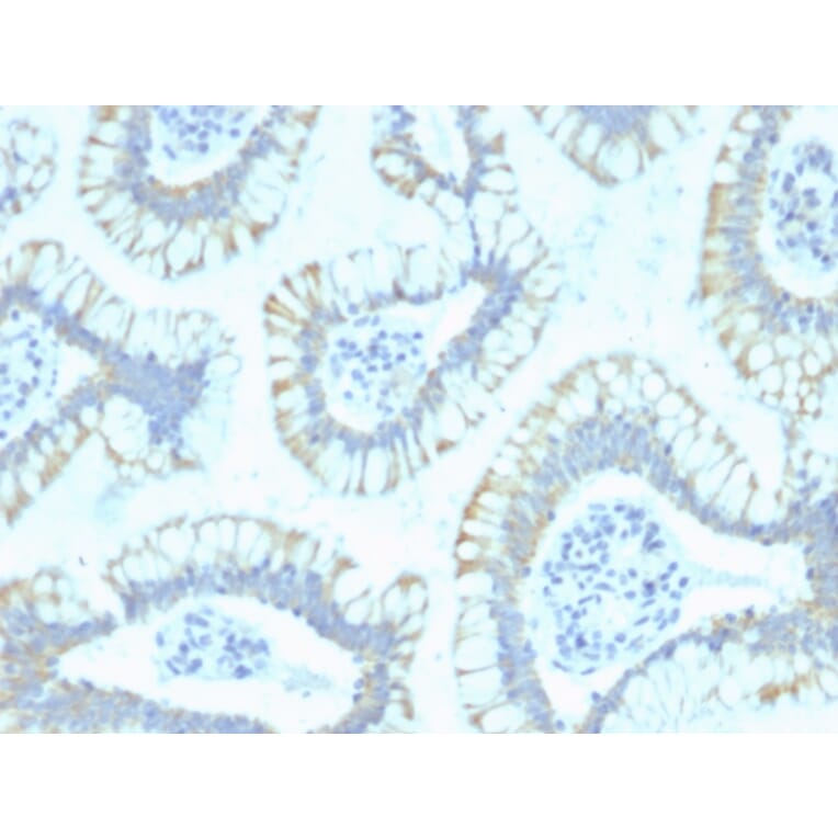 Immunohistochemistry - Anti-SMAD4 Antibody [SPM448] - BSA and Azide free (A252451) - Antibodies.com