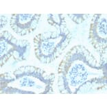 Immunohistochemistry - Anti-SMAD4 Antibody [SPM448] - BSA and Azide free (A252451) - Antibodies.com