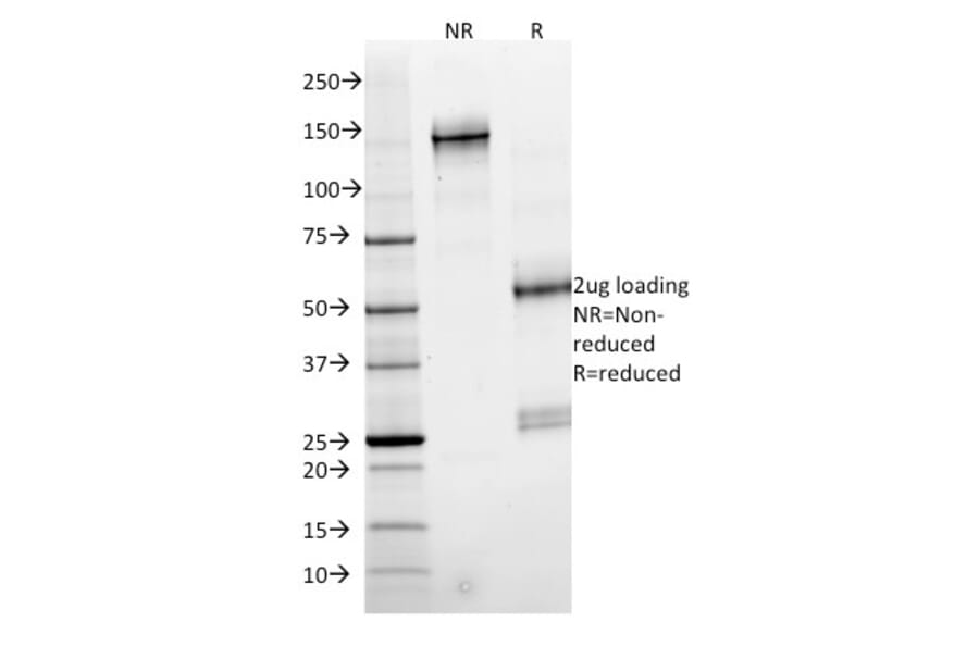 SDS-PAGE - Anti-SMAD4 Antibody [SMAD4/2524] - BSA and Azide free (A252452) - Antibodies.com