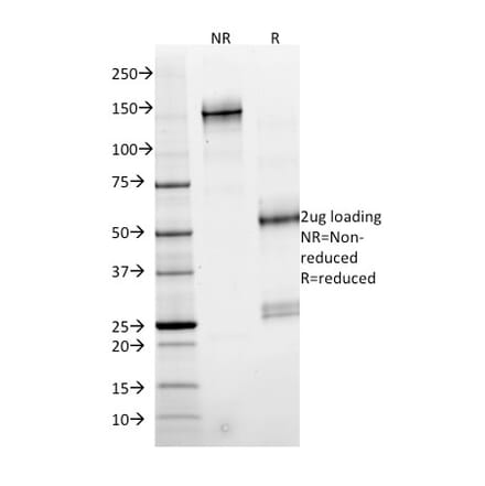 SDS-PAGE - Anti-SMAD4 Antibody [SMAD4/2524] - BSA and Azide free (A252452) - Antibodies.com