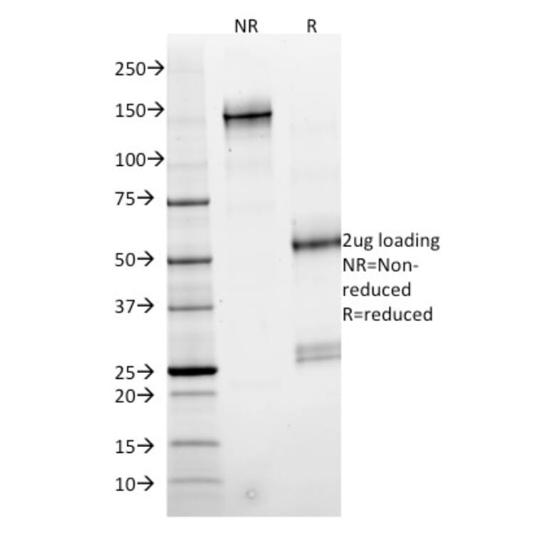 SDS-PAGE - Anti-SMAD4 Antibody [SMAD4/2524] - BSA and Azide free (A252452) - Antibodies.com