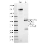 SDS-PAGE - Anti-SMAD4 Antibody [SMAD4/2524] - BSA and Azide free (A252452) - Antibodies.com