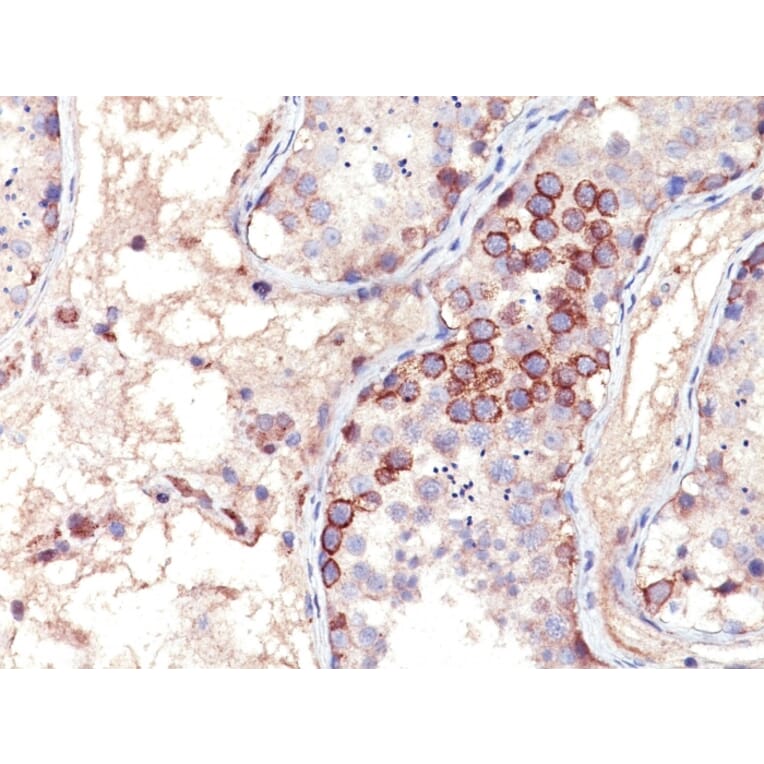 Immunohistochemistry - Anti-MAGE 1 Antibody [MA454] - BSA and Azide free (A252453) - Antibodies.com