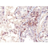 Immunohistochemistry - Anti-MAGE 1 Antibody [MA454] - BSA and Azide free (A252453) - Antibodies.com