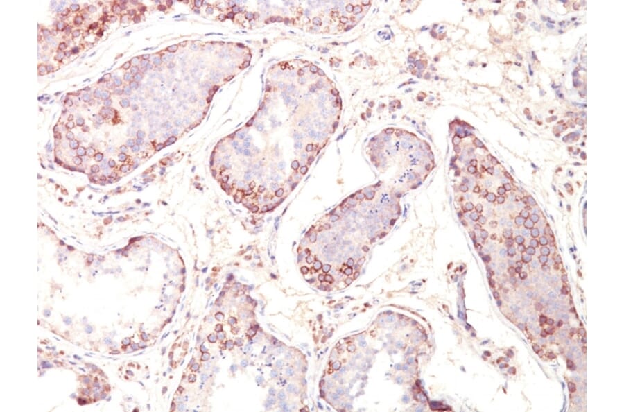 Immunohistochemistry - Anti-MAGE 1 Antibody [MZ2E/838] - BSA and Azide free (A252455) - Antibodies.com