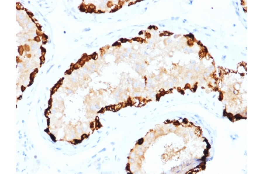 Immunohistochemistry - Anti-MAGEA4 Antibody [CPTC-MAGEA4-1] - BSA and Azide free (A252457) - Antibodies.com