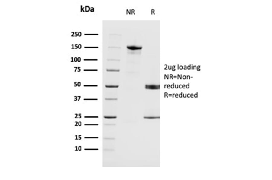 SDS-PAGE - Anti-MAGEA4 Antibody [CPTC-MAGEA4-1] - BSA and Azide free (A252457) - Antibodies.com