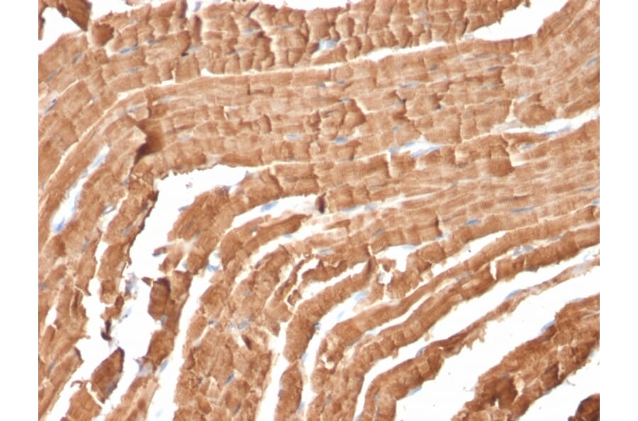 Immunohistochemistry - Anti-Myoglobin Antibody [MB/2105] - BSA and Azide free (A252457) - Antibodies.com