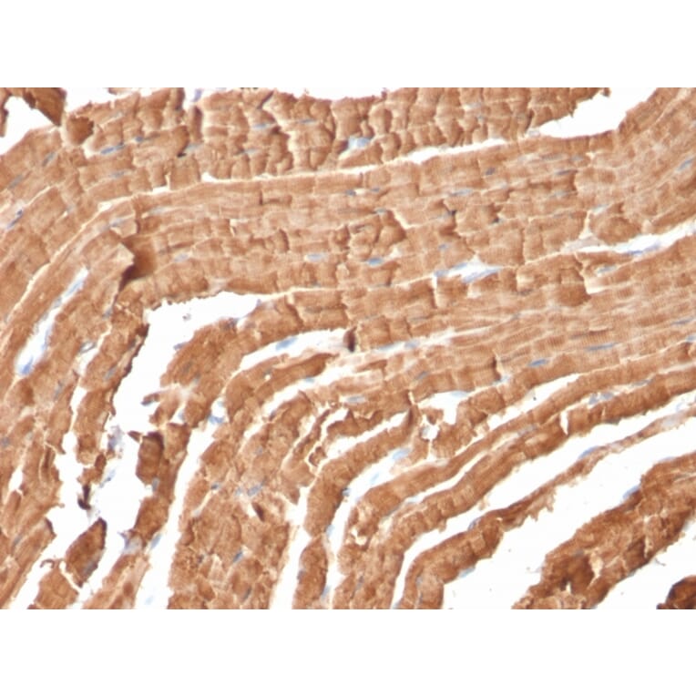 Immunohistochemistry - Anti-Myoglobin Antibody [MB/2105] - BSA and Azide free (A252457) - Antibodies.com