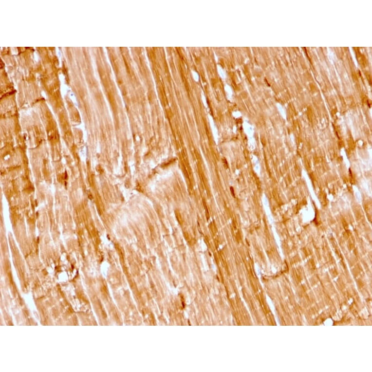 Immunohistochemistry - Anti-Myoglobin Antibody [rMB/2105] - BSA and Azide free (A252458) - Antibodies.com