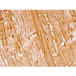 Immunohistochemistry - Anti-Myoglobin Antibody [rMB/2105] - BSA and Azide free (A252458) - Antibodies.com