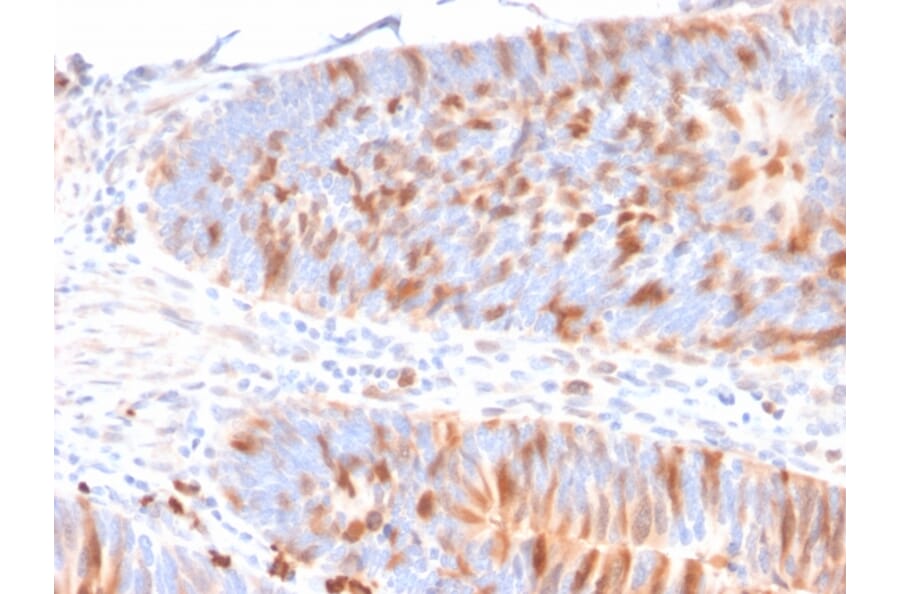 Immunohistochemistry - Anti-MBD1 Antibody [CPTC-MBD1-1] - BSA and Azide free (A252459) - Antibodies.com