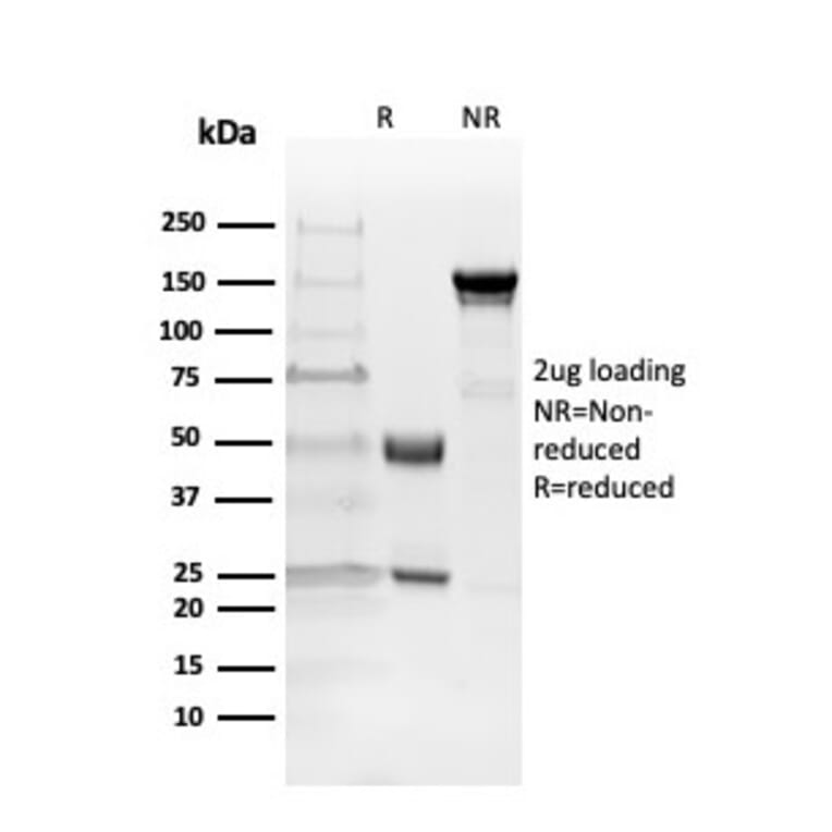 SDS-PAGE - Anti-Myelin Basic Protein Antibody [MBP/4271] - BSA and Azide free (A252461) - Antibodies.com