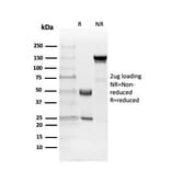 SDS-PAGE - Anti-Myelin Basic Protein Antibody [MBP/4271] - BSA and Azide free (A252461) - Antibodies.com