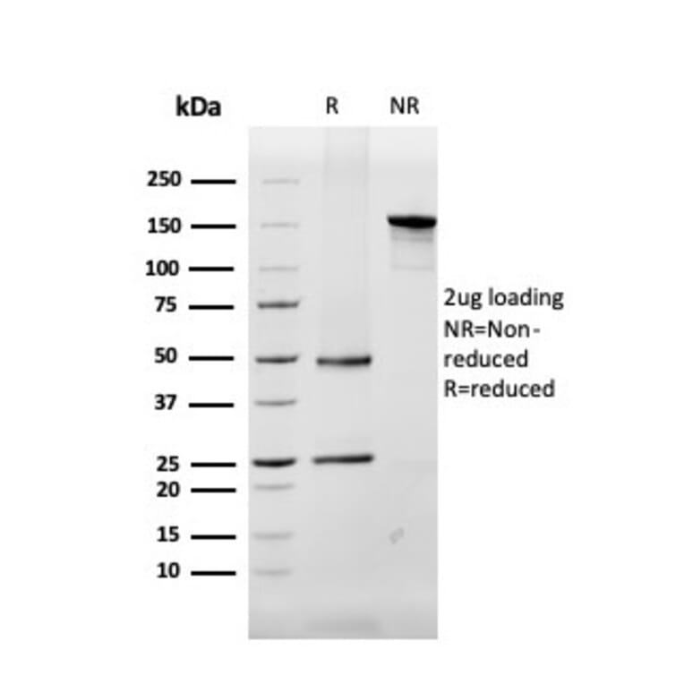 SDS-PAGE - Anti-Myelin Basic Protein Antibody [MBP/4272] - BSA and Azide free (A252462) - Antibodies.com