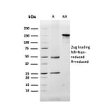 SDS-PAGE - Anti-Myelin Basic Protein Antibody [MBP/4272] - BSA and Azide free (A252462) - Antibodies.com