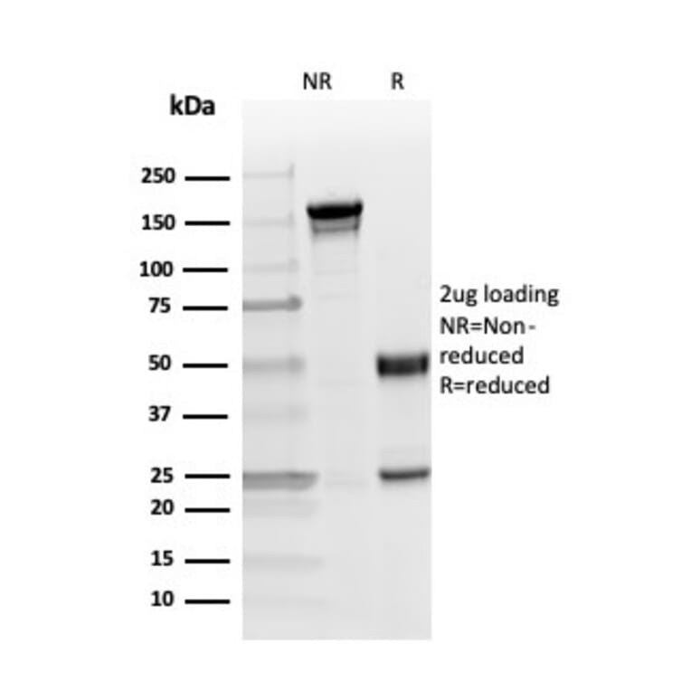 SDS-PAGE - Anti-Myelin Basic Protein (phospho Thr98) Antibody [MBP/4276] - BSA and Azide free (A252463) - Antibodies.com