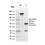 SDS-PAGE - Anti-Myelin Basic Protein (phospho Thr98) Antibody [MBP/4276] - BSA and Azide free (A252463) - Antibodies.com