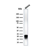 Western Blot - Anti-Myelin Basic Protein (phospho Thr98) Antibody [MBP/4276] - BSA and Azide free (A252463) - Antibodies.com