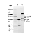 SDS-PAGE - Anti-Myelin Basic Protein Antibody [MBP/4277R] - BSA and Azide free (A252465) - Antibodies.com