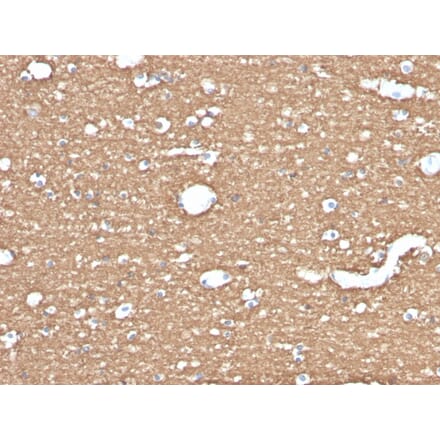 Immunohistochemistry - Anti-Myelin Basic Protein Antibody [MBP/4275] - BSA and Azide free (A252468) - Antibodies.com