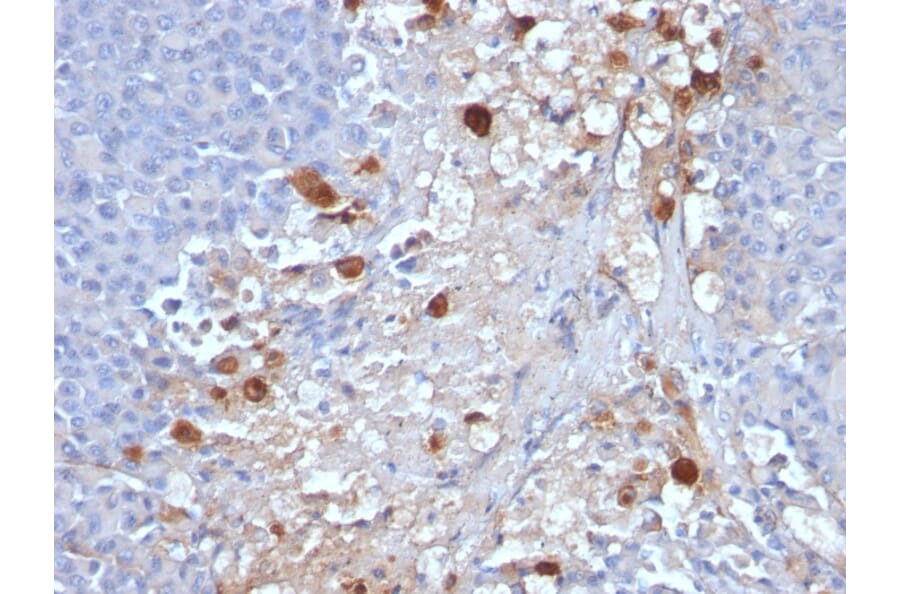Immunohistochemistry - Anti-CD146 Antibody [MCAM/1101] - BSA and Azide free (A252470) - Antibodies.com