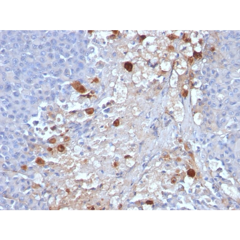 Immunohistochemistry - Anti-CD146 Antibody [MCAM/1101] - BSA and Azide free (A252470) - Antibodies.com