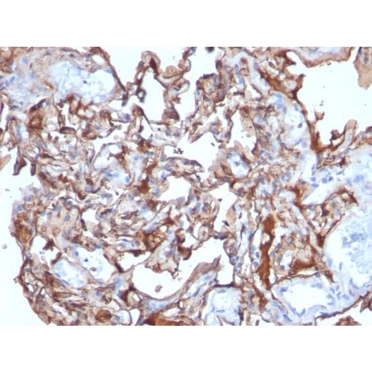 Immunohistochemistry - Anti-CD146 Antibody [MCAM/1101] - BSA and Azide free (A252468) - Antibodies.com