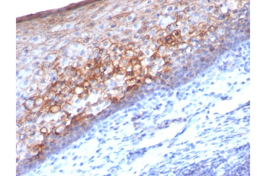 Immunohistochemistry - Anti-CD146 Antibody [MCAM/1101] - BSA and Azide free (A252470) - Antibodies.com
