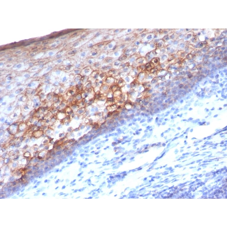 Immunohistochemistry - Anti-CD146 Antibody [MCAM/1101] - BSA and Azide free (A252470) - Antibodies.com