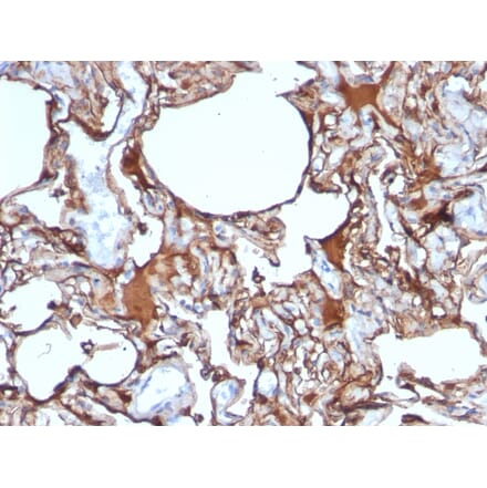 Immunohistochemistry - Anti-CD146 Antibody [SPM620] - BSA and Azide free (A252470) - Antibodies.com