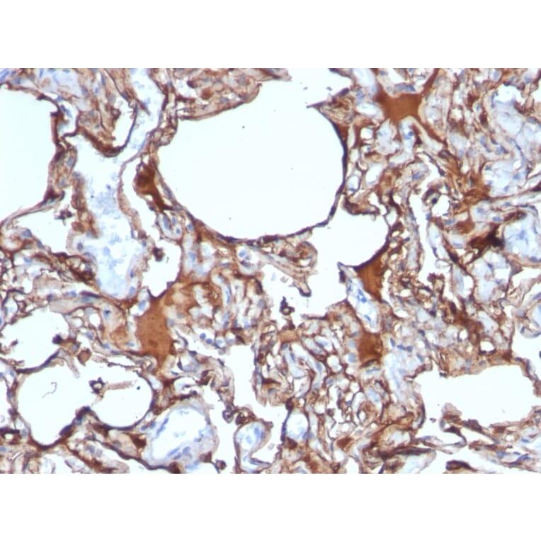 Immunohistochemistry - Anti-CD146 Antibody [SPM620] - BSA and Azide free (A252470) - Antibodies.com