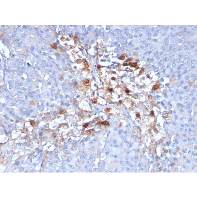 Immunohistochemistry - Anti-CD146 Antibody [C146/634] - BSA and Azide free (A252471) - Antibodies.com