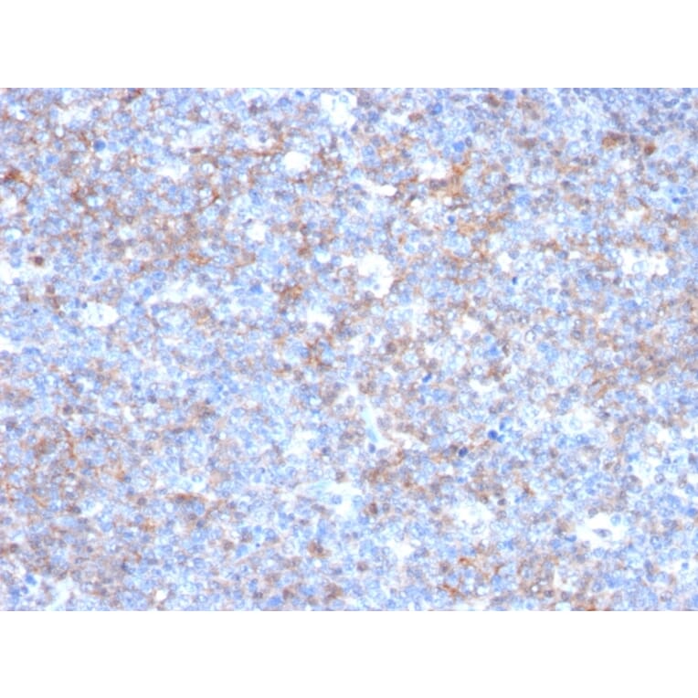 Immunohistochemistry - Anti-CD146 Antibody [C146/634] - BSA and Azide free (A252472) - Antibodies.com