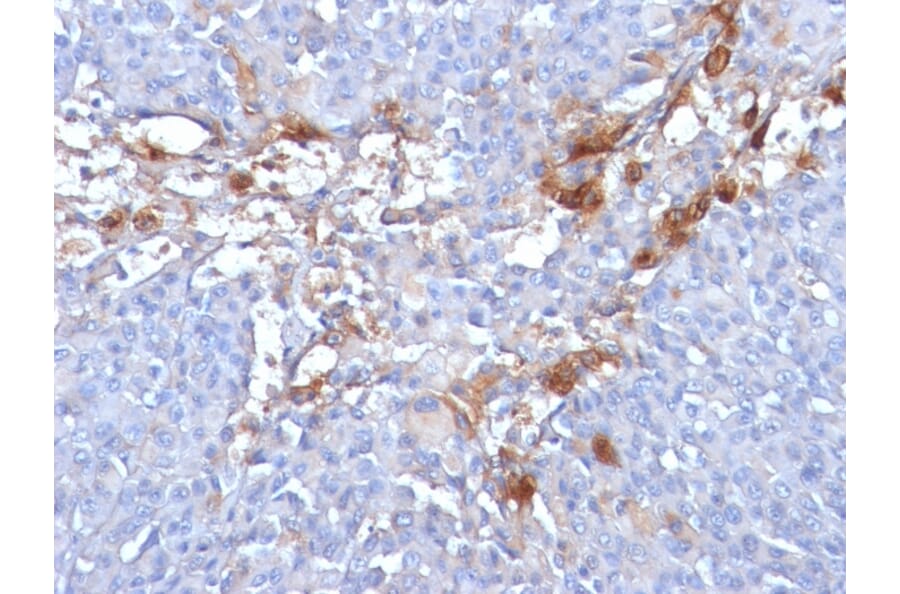 Immunohistochemistry - Anti-CD146 Antibody [MUC18/1130] - BSA and Azide free (A252472) - Antibodies.com