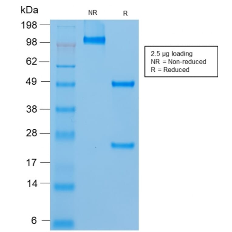 SDS-PAGE - Anti-CD146 Antibody [rMUC18/1130] - BSA and Azide free (A252474) - Antibodies.com