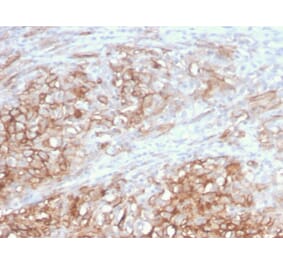 Immunohistochemistry - Anti-CD146 Antibody [MCAM/3046] - BSA and Azide free (A252475) - Antibodies.com