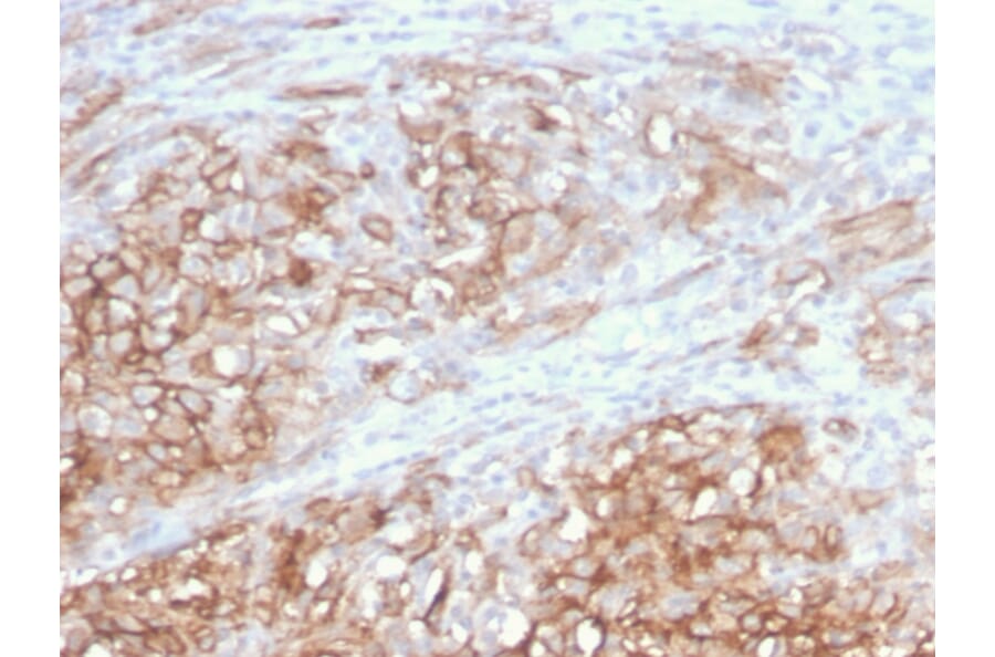 Immunohistochemistry - Anti-CD146 Antibody [MCAM/3046] - BSA and Azide free (A252475) - Antibodies.com