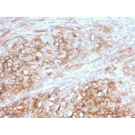 Immunohistochemistry - Anti-CD146 Antibody [MCAM/3046] - BSA and Azide free (A252475) - Antibodies.com