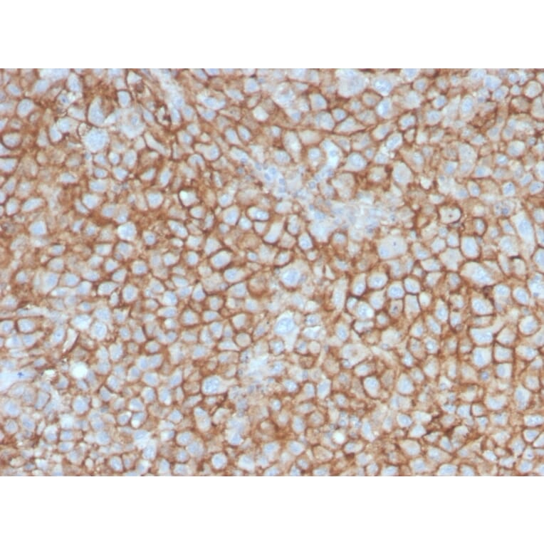 Immunohistochemistry - Anti-CD146 Antibody [MCAM/3046] - BSA and Azide free (A252475) - Antibodies.com