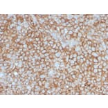 Immunohistochemistry - Anti-CD146 Antibody [MCAM/3046] - BSA and Azide free (A252475) - Antibodies.com