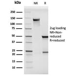 SDS-PAGE - Anti-CD146 Antibody [MCAM/3046] - BSA and Azide free (A252475) - Antibodies.com