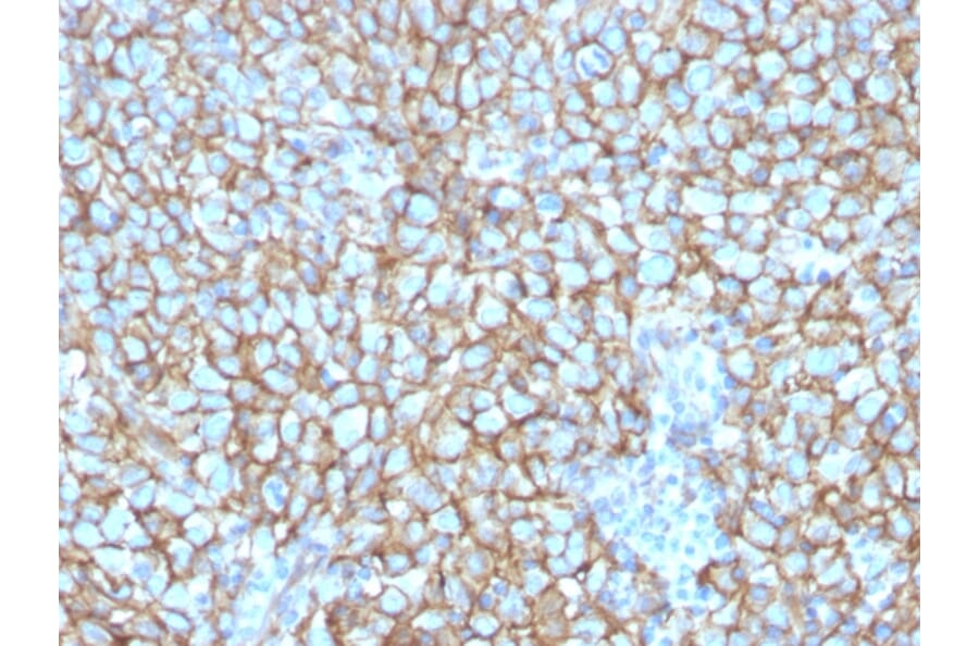 Immunohistochemistry - Anti-CD146 Antibody [MCAM/3048] - BSA and Azide free (A252476) - Antibodies.com