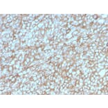 Immunohistochemistry - Anti-CD146 Antibody [MCAM/3048] - BSA and Azide free (A252476) - Antibodies.com