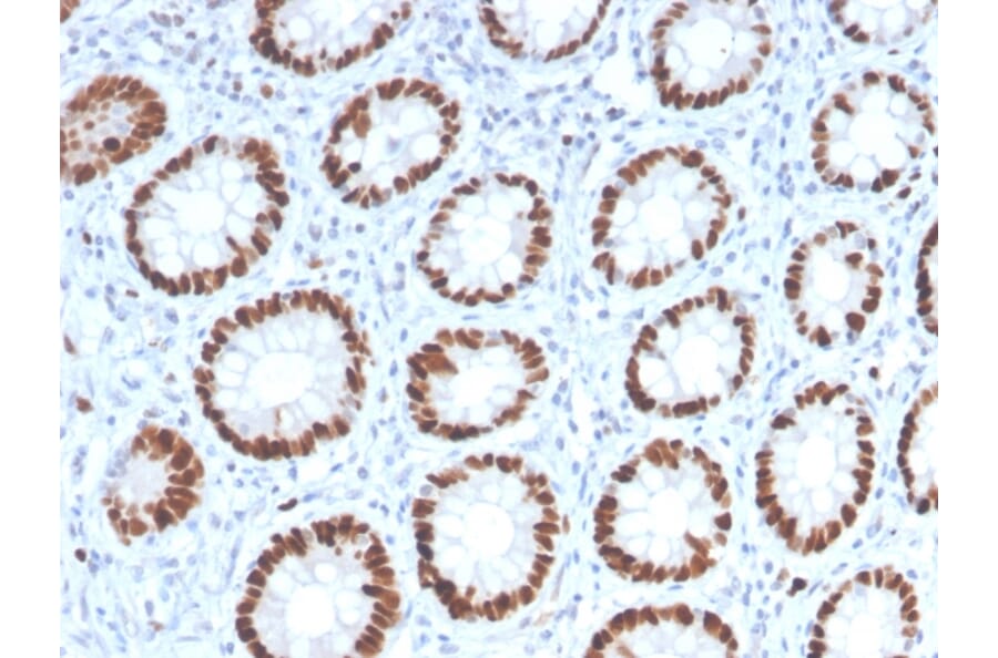 Immunohistochemistry - Anti-MCM6 Antibody [MCM6/2999] - BSA and Azide free (A252478) - Antibodies.com