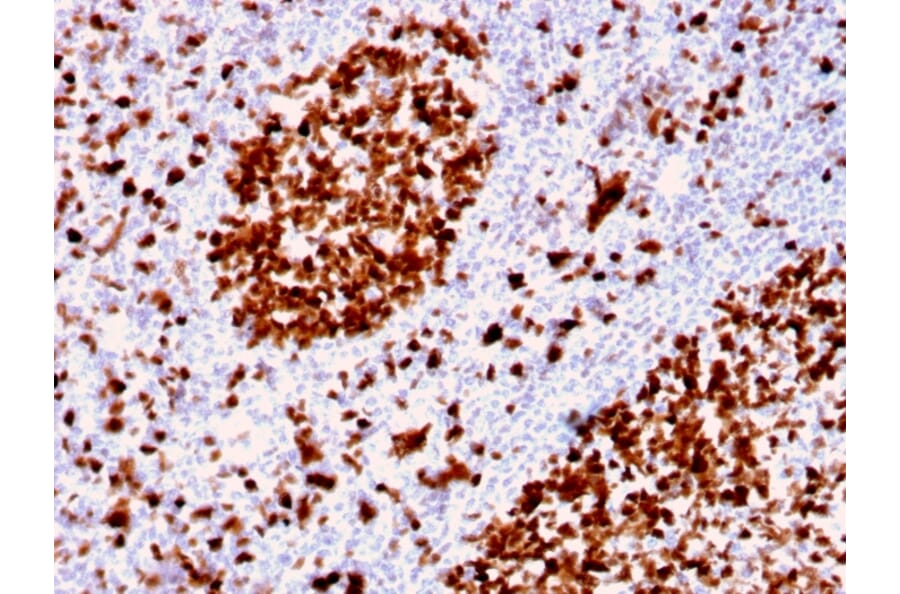 Immunohistochemistry - Anti-MCM6 Antibody [MCM6/2999] - BSA and Azide free (A252478) - Antibodies.com