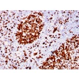 Immunohistochemistry - Anti-MCM6 Antibody [MCM6/2999] - BSA and Azide free (A252478) - Antibodies.com