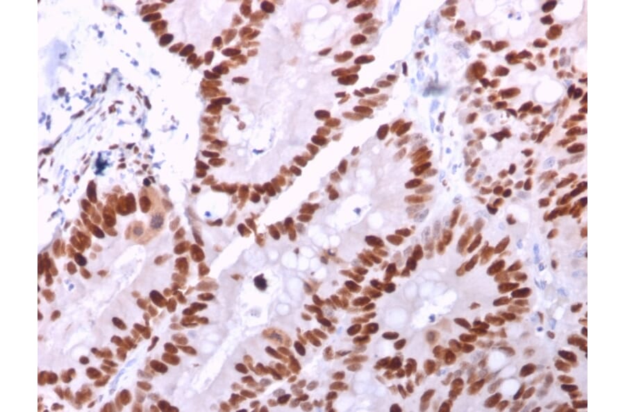 Immunohistochemistry - Anti-MCM6 Antibody [MCM6/2999] - BSA and Azide free (A252478) - Antibodies.com